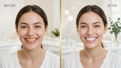 7.5% Nano Hydroxyapatite Fluoride Toothpaste for Teeth Whitening